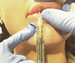 Screenshot of Martina Collins Dental & Skin Clinic video